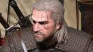 The Witcher 3 en retard, de nombreux bugs restent  corriger